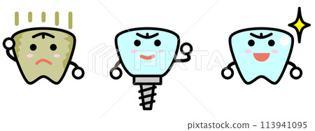 An illustration of a yellowed tooth that has been replaced by an implant at a dentist 113941095