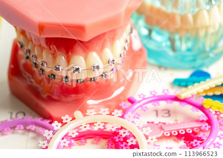 Orthodontic ligatures rings and ties, elastic rubber bands on orthodontic braces, model for dentist studying about dentistry. 113966523