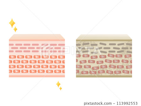 皮膚圖對比圖 113992553