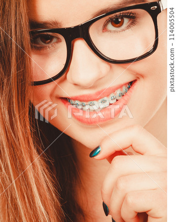 Happy nerdy teenage in eyeglasses showing braces Happy nerdy teenage in eyeglasses showing braces 114005504