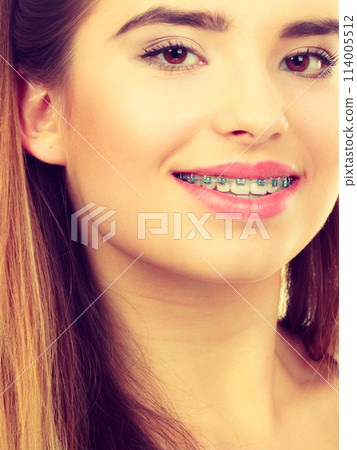 Woman showing her teeth with braces Woman showing her teeth with braces 114005512