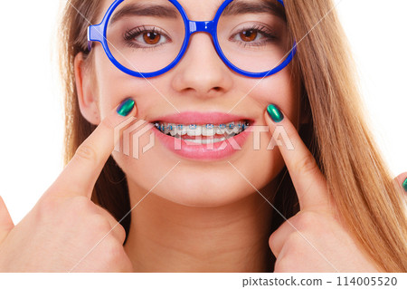 Happy nerdy teenage in eyeglasses showing braces 114005520