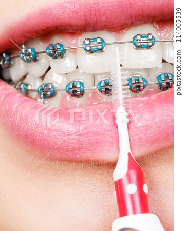 Woman brushing teeth with braces using brush 114005539