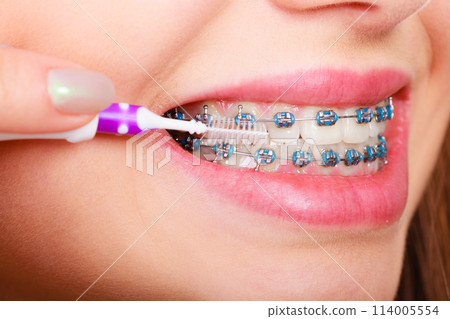 Woman brushing teeth with braces using brush 114005554
