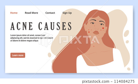 Girl with acne, problem skin banner. Cartoon scene skin problem isolated on white background. Girl with acne, problem skin banner. Cartoon scene skin problem isolated on white background. 114084275