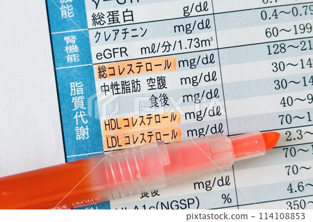 健康檢查項目中檢查膽固醇 健康檢查項目中檢查膽固醇 114108853