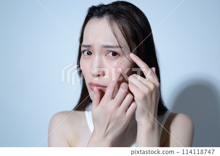 Image of a woman suffering from age spots Image of a woman suffering from age spots 114118747