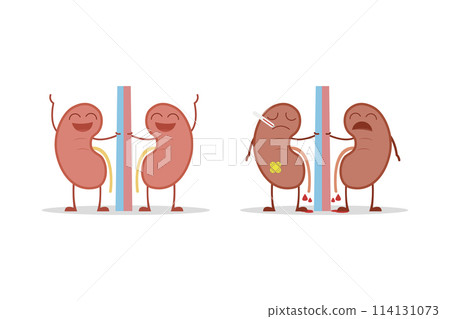 Healthy and sick kidneys isolated on white background vector illustration 114131073