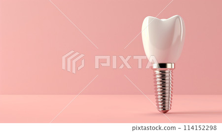 Exploring the benefits of tooth implants with space for text explanations 114152298