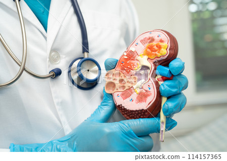 Kidney disease, Chronic kidney disease ckd, Doctor with human model to study and treat in hospital. Kidney disease, Chronic kidney disease ckd, Doctor with human model to study and treat in hospital. 114157365