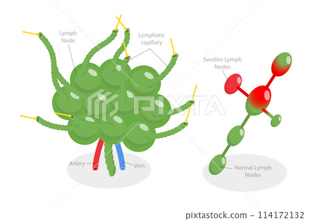3D Isometric Flat Conceptual Illustration of Lymph Node, Labeled Diagram 3D Isometric Flat Conceptual Illustration of Lymph Node, Labeled Diagram 114172132