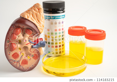 Urinalysis, Kidney model and urine cup with reagent strip pH paper test and comparison chart in laboratory. Urinalysis, Kidney model and urine cup with reagent strip pH paper test and comparison chart in laboratory. 114183215