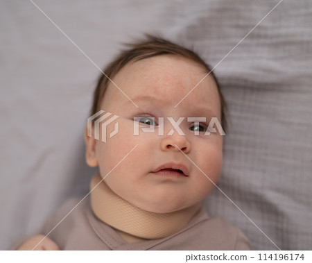 Top view of a newborn baby wearing an orthopedic collar. Top view of a newborn baby wearing an orthopedic collar. 114196174