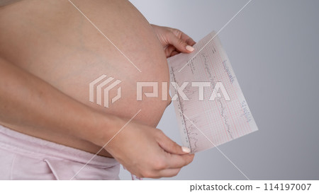 Pregnant woman with bare belly holding Cardiotocography results. Pregnant woman with bare belly holding Cardiotocography results. 114197007