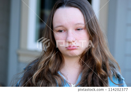 sad face of a beautiful girl crying under puffy eyes light allergy freckles on the street close face upset teenage girl young woman first love troubles adolescence problems psychological children sad face of a beautiful girl crying under puffy eyes light allergy freckles on the street close face upset teenage girl young woman first love troubles adolescence problems psychological children 114202377