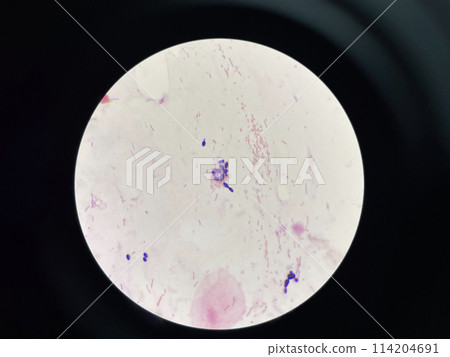 Yeast cell in gram stain. 114204691