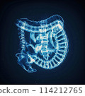 Blue x-ray medical illustration of the gastrointestinal tract, focusing on colon and small intestine anatomy for medical students 114212765