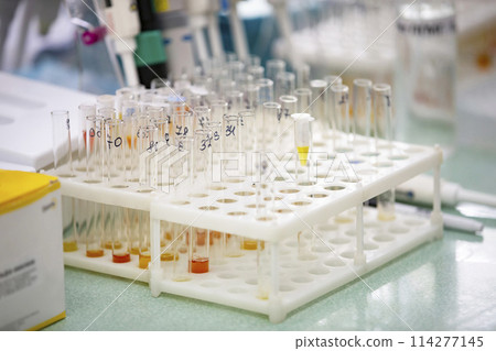 Many glass test tubes with analyzes in a medical laboratory. 114277145