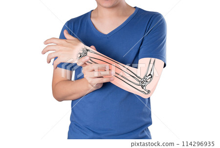 arm bone injury arm bone injury 114296935