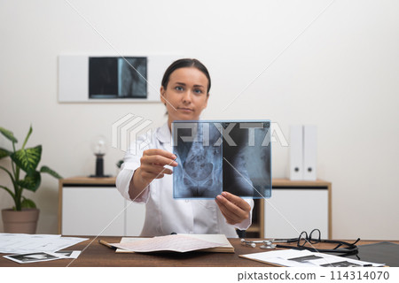 female doctor engages in a telemedicine consultation, pointing at an X-ray film while explaining the pathology to the patient online, looking to camera. female doctor engages in a telemedicine consultation, pointing at an X-ray film while explaining the pathology to the patient online, looking to camera. 114314070