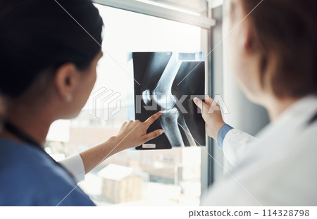 Doctor, nurse and xray in radiology for bones in patient with examination, pointing for treatment in clinic. Medical, professionals and hospital with scan for diagnosis, wellness and healthcare Doctor, nurse and xray in radiology for bones in patient with examination, pointing for treatment in clinic. Medical, professionals and hospital with scan for diagnosis, wellness and healthcare 114328798