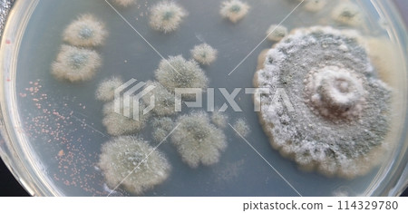 Mold spores seen through a magnifying glass 114329780