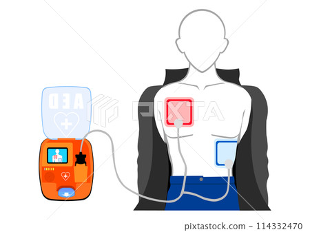Install an AED (Automated External Defibrillator) 114332470