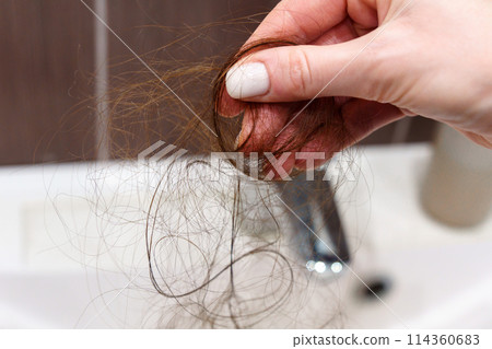 Struggles of Hair Loss. A Personal Journey confronting hair loss. Selective focus 114360683