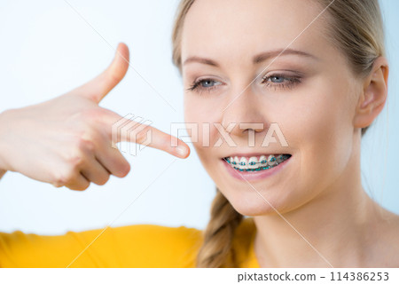 Woman showing her teeth with braces 114386253