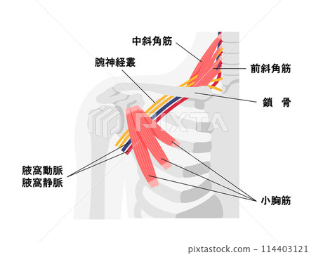 胸廓出口症候群發生部位的圖示。 胸廓出口症候群發生部位的圖示。 114403121