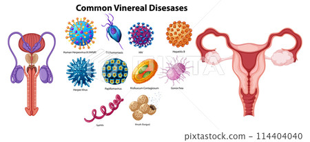 Illustration of Common Venereal Diseases Illustration of Common Venereal Diseases 114404040