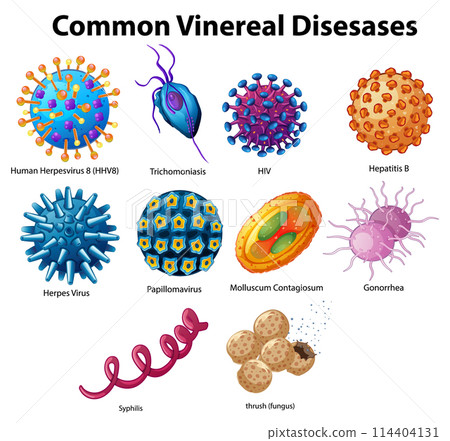 Illustration of Common Venereal Diseases 114404131