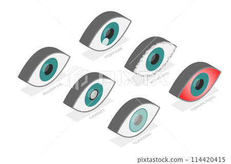 3D Isometric Flat Set of Eyes with Different Problems, Human Eye and Vision Health 3D Isometric Flat Set of Eyes with Different Problems, Human Eye and Vision Health 114420415