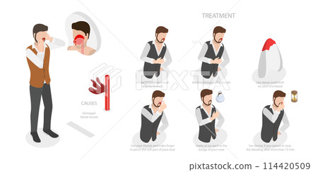 3D Isometric Flat  Conceptual Illustration of Nose Bleeding, Causes and Treatment 114420509