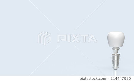 The dental implants for health and medical concept 3d rendering. 114447950