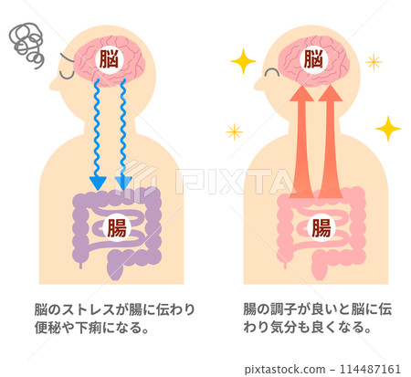 壓力如何導致胃痛以及大腦和腸道之間的關係。腦腸相關性的例證。 114487161