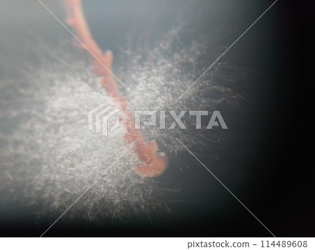 顯微鏡下觀察黴菌孢子 114489608