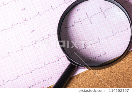 Magnifier on cardiogram 114502397