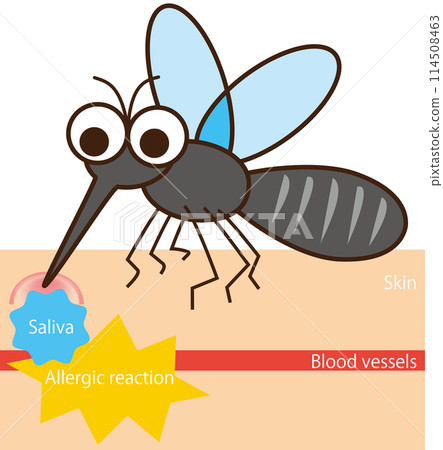 癢！夏季煩惱昆蟲叮咬「蚊子」插畫 114508463