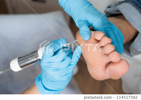 Professional removing a callus on a womans foot by electric drill 114517382