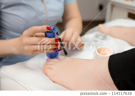 Podiatrist applies a titanium thread to a toenail and employs a UV lamp 114517638