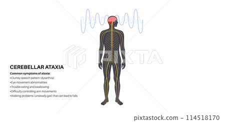 Ataxia cerebellar disorder Ataxia cerebellar disorder 114518170