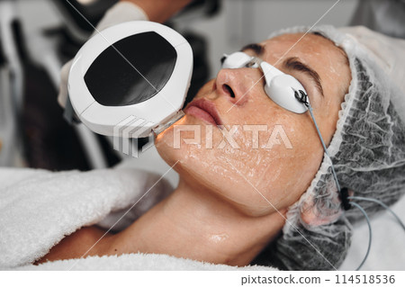 A woman receives IPL therapy in a beauty salon. 114518536