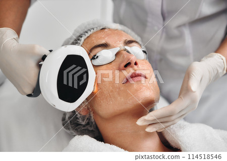 A woman receives IPL therapy in a beauty salon. A woman receives IPL therapy in a beauty salon. 114518546