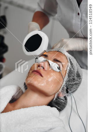 A woman receives IPL therapy in a beauty salon. A woman receives IPL therapy in a beauty salon. 114518549