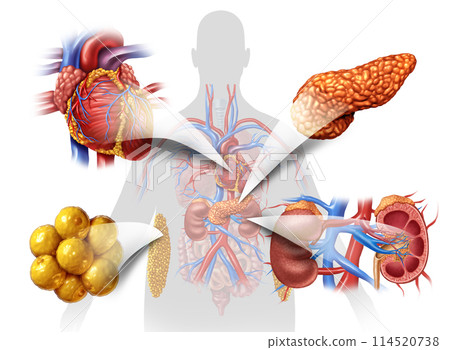 cardiovascular-kidney-metabolic syndrome 114520738