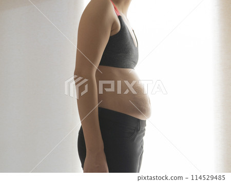 A woman's hunchbacked belly with stretch marks after giving birth 114529485