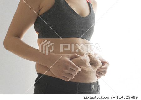 A woman pinching her belly fat that still has stretch marks after giving birth 114529489