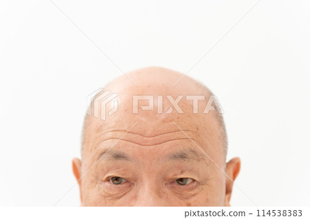 Senior male beauty forehead 114538383