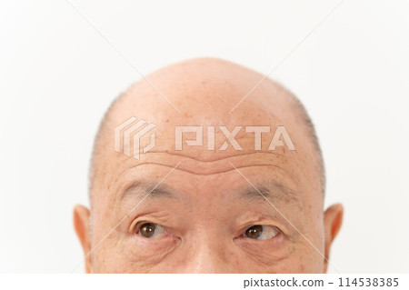 高級男性美女額頭 114538385